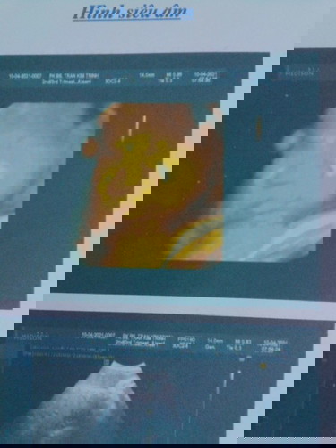 39tuần2 ngày trông từng ngày mà chưa có rụt rịt j hết các mom ạ