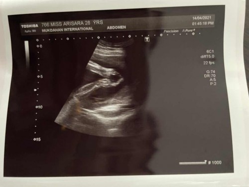 สวัสดีไทยแลนด์นะคะคุณแม่ทุกคน 💕