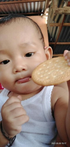 suntik campak