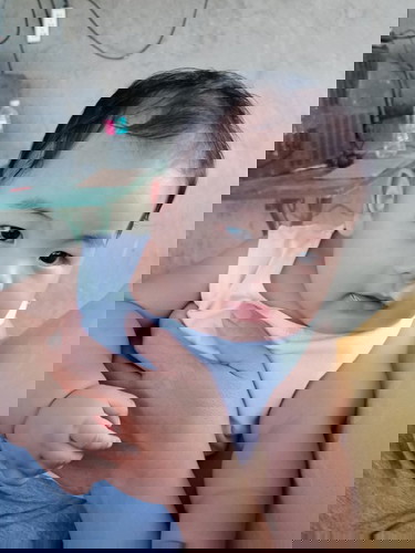 Pain in CS Section incision