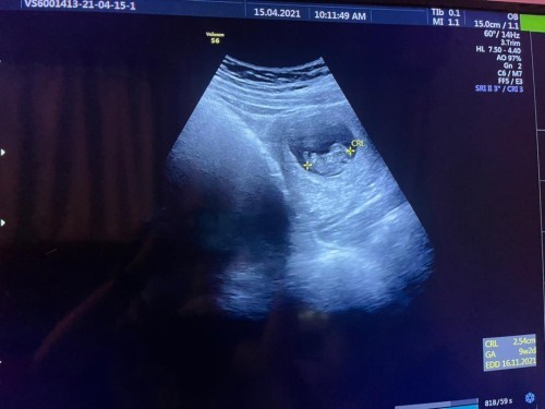 Siapa dia scan harini sepatutnya 9 week 4 day jd 9 week 2 day?? Jd anjak dua hari dari tarikh due asal 😂