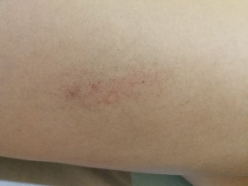 Tiny red spots