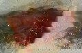 Vaginal discharge