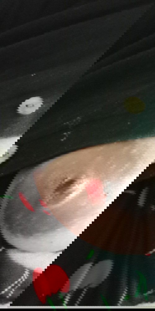 Bleeding nipples due to breastfeeding