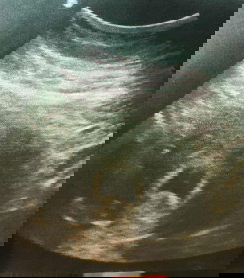 รบกวนแม่ ๆ ช่วยแปลผลให้หน่อยค่ะ 🥰