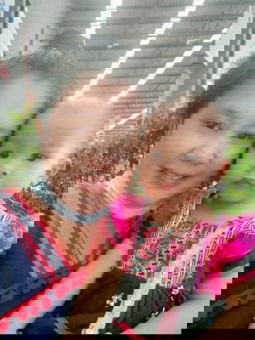 อาการหัวร้อย