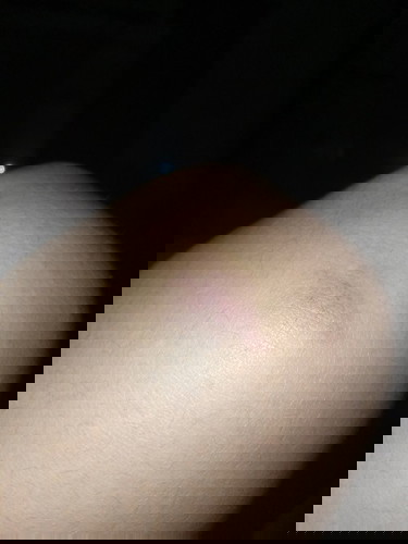 Usia kehamilan 28 weeks