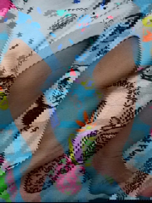 Normal atau tidak..??