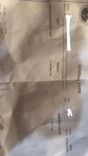 Nagpaserum test po ako and eto po yung result.