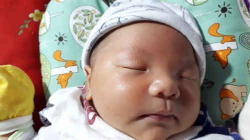 Bé sóc 6 ngày tuổi