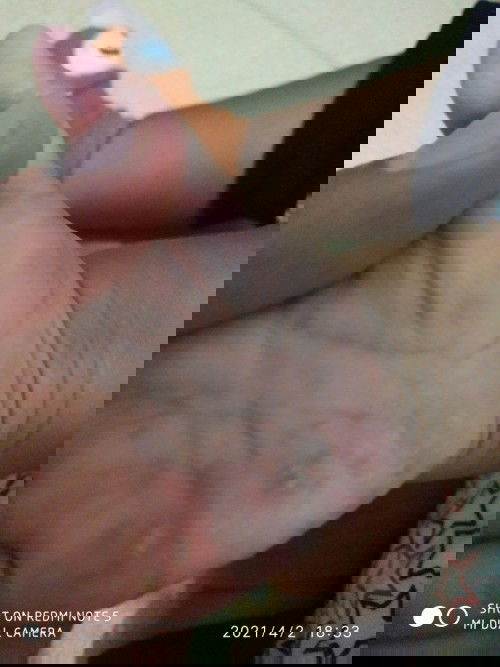 Obat gatel apa ang ampuh?