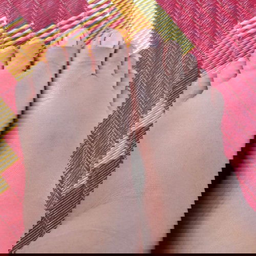 มือเท้ามีอาการปวดและบวม 38w+2d