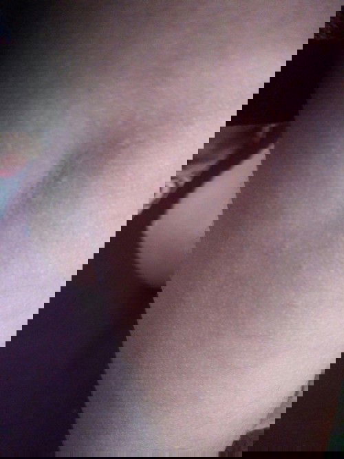 Bintik merah di bagian lengan dan kaki