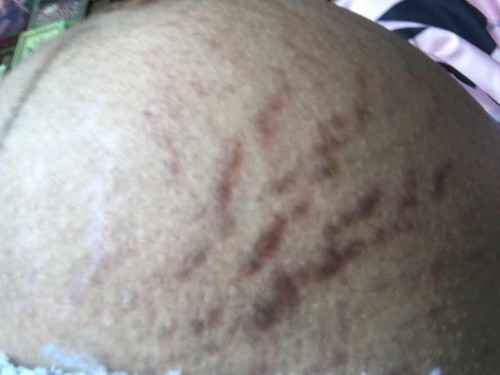 แม่บ้านไหนท้องแตกลายบ้าง