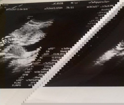 กังวลว่าลูกจะแข็งแรงไหม น้ำหนักน้อย 
ลูกอายุ 4 เดือนแล้ว