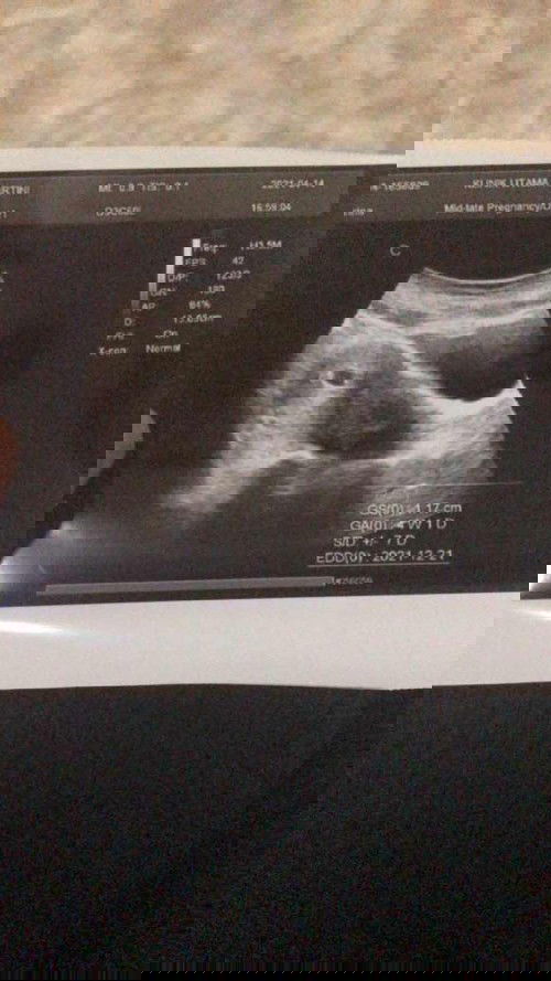 🙂🙂🙂🙂🙂🙂🙂🙂🙂🙂🙂🙂