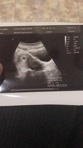 ππππππππππππ