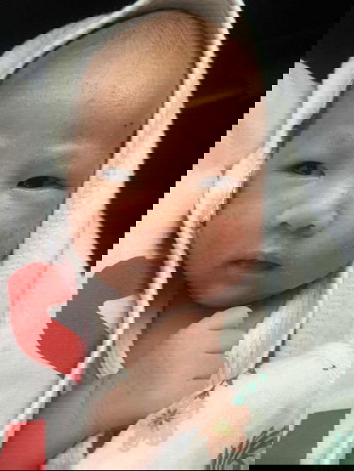 จากตอนแรกหน้าลูกเป็นผื่นทั่ว ถึงหู ตอนนี้หาแล้วค่ะ ขยันทำความสะอาด วิธีง่ายๆ ดีกว่าใช้ยาหมอเยอะเลย