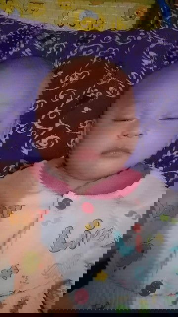 BAB bayi ada bercak merah