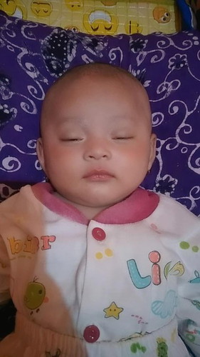 BAB bayi ada bercak merah