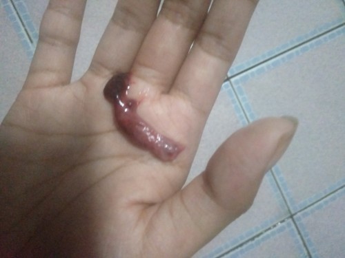 แบบนี้ใช่ลูกหลุดมั้ยคะ