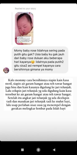 Lidah putih pada bayi