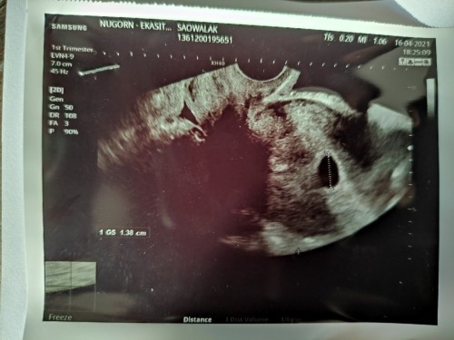 สอบถามค่ะ เพิ่งไปus มา