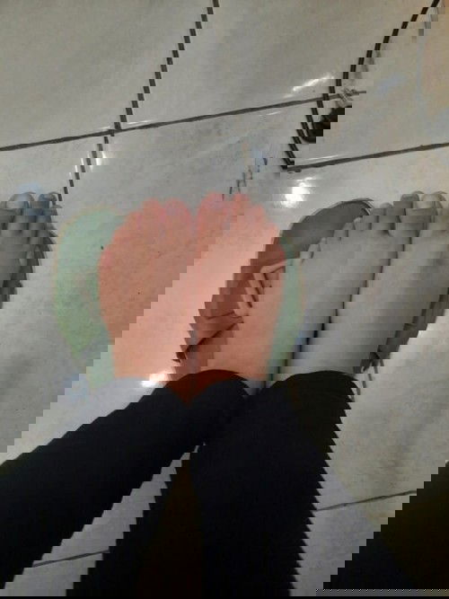 Bengkak tangan dan kaki di usia kehamilan 18week