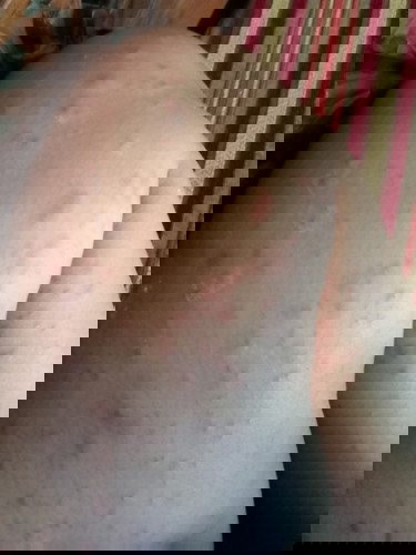 Saya hamil pertama dan bayi saya laki", saya mengalami gatal" seluruh tubuh, apakah itu normal ???