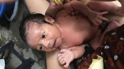 ผ่าคลอด3530กรัม🤰🏻