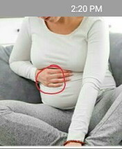 rib pain pregnancy