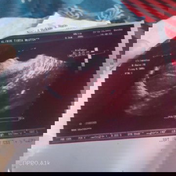 Assalamualaikum bunda2 mau tanya ini hasil USG bulan lalu.. kata spog nya aku tidak hamil..