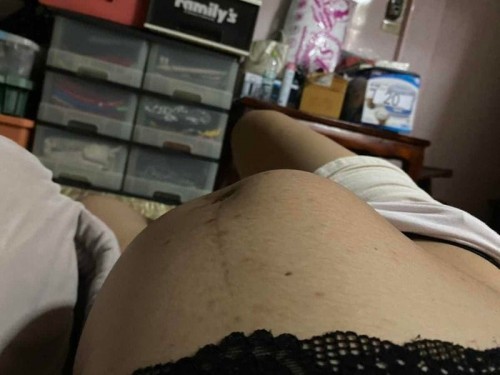 เวลานอนตะแคงลูกโก่งตัว