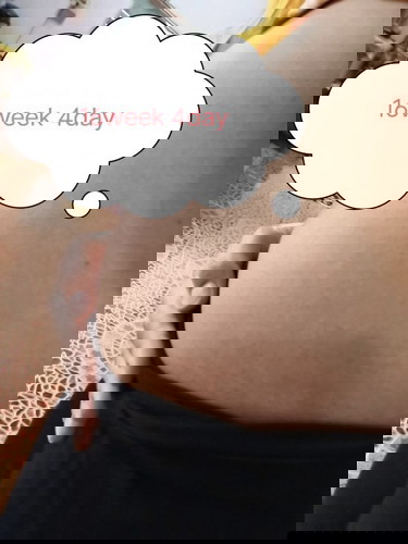 ผลเลือดภาวะดาวน์ซินโดรมเสี่ยงสูงต้องได้เจาะน่ำคร่ำ..ใจแม่นิกังวลและกลัวมากจ้า