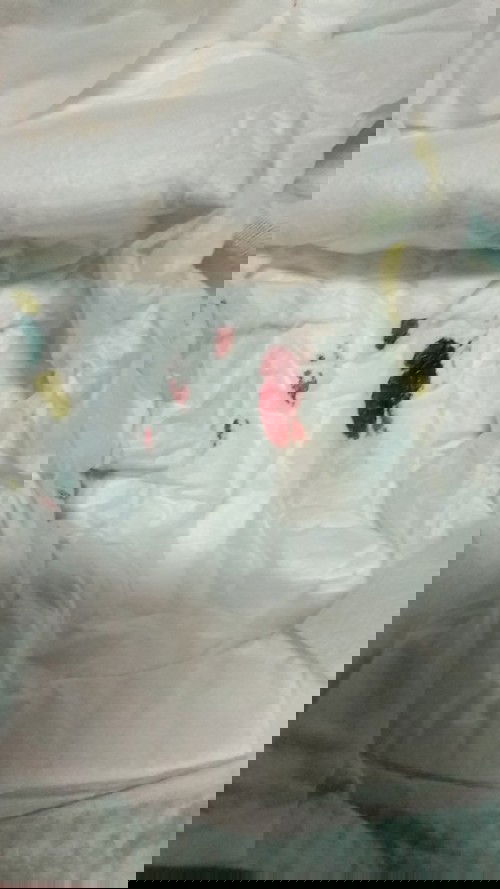 keluar darah dari vagina