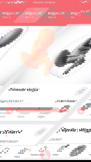 Janin masih sungsang