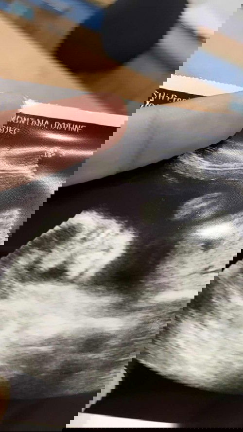 Si bulinggit ay Baby Girl 💖