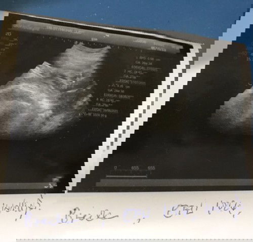 เเม่ๆบ้านไหนดูออกบ้างค่ะ