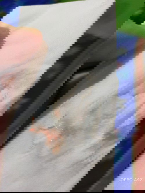 Kluar lendir campur darah jam 10