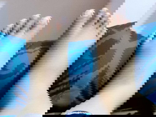 KAKI BENGKAK SETELAH MELAHIRKAN