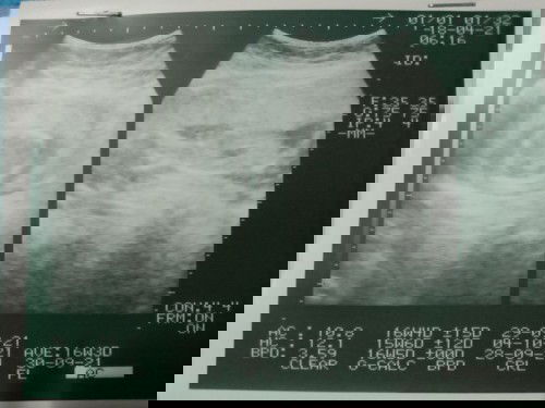 น้ำหนักน้อง