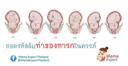 ไขข้อสงสัยที่คุณหมอ บันทึก ท่านำของลูกน้อย