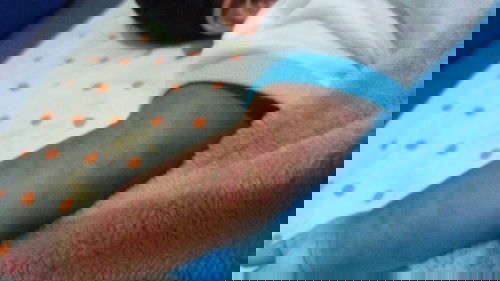 Ruam Kulit pada bayi / kulit bayi merah