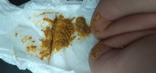 Bé nhà em đi ngoài. Ntn. Nhìu. Lần trong 1 ngày có đã lo ạ
Bé uống sữa ngồi hoàn toàn