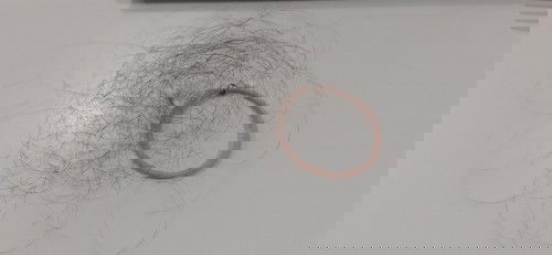 Rambut rontok hamil 12week