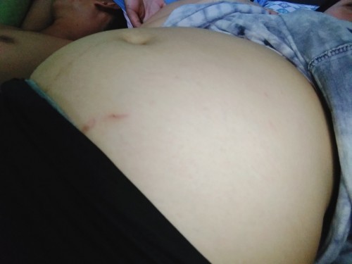 First time mom po ako. 4months preggy. Dpa po ako nkakapag pa check up dhil pandemic.