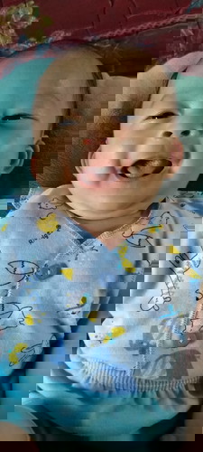 Ini bayiku usianya 1bln 10 hari apakah sudah bisa di kasi bedak bun di mukanya dan badannya?