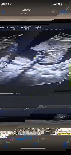 แบบนี้น้องผู้หญิงหรือผู้ชายคะ