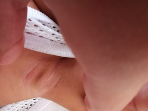 Armpit and neck rashes and redness