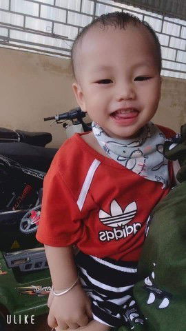 Đang bầu 36w4d mà mọc răng khôn có làm sao k các mom ơi